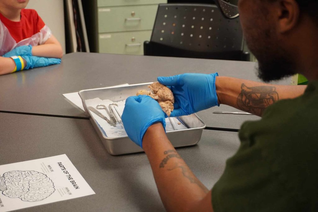 An educator wearing gloves demonstrates a preserved brain on a tray during a hands-on science activity with children.
